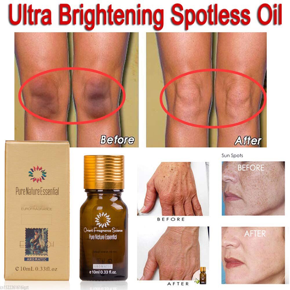 Ultra Brightening Spotless Skin Care Pure Natural